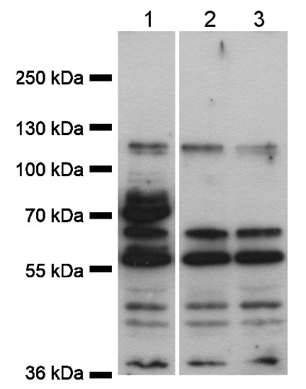 Western blot using anti-CPK1 antibodies